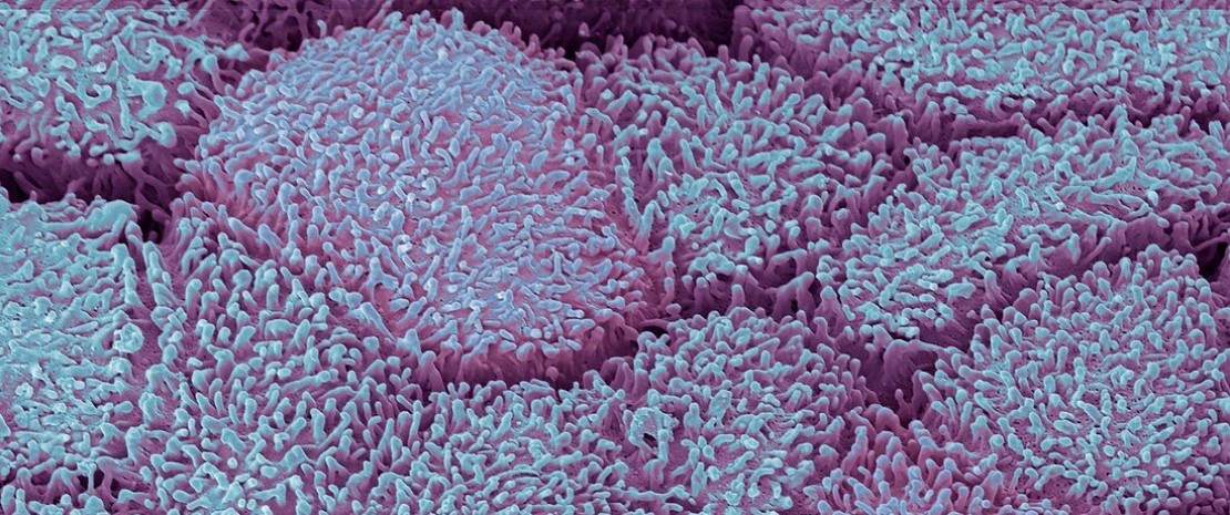 Photo: Le microbiote urogénital masculin sous l’influence des rapports sexuels vaginaux