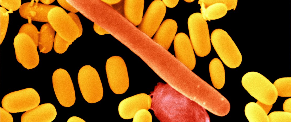 Clostridium difficile spores surrounding a long Cl. difficile bacterium.