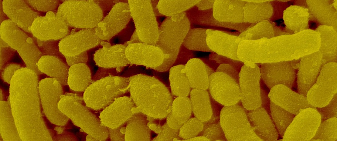 Coloured scanning electron micrograph (SEM) of Prevotella melaninogenica, formerly known as Bacteroides melaninogenicus, is Gram-negative, anaerobic, rod to coccobacillus shaped, prokaryote (bacterium)