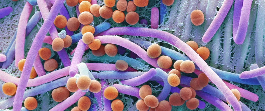 Faecal bacteria. Scanning electron micrograph (SEM) of bacteria cultured from a sample of human faeces.