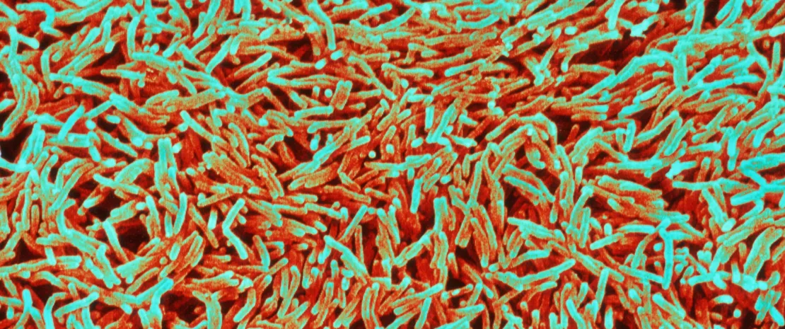 Coloured scanning electron micrograph (SEM) of Mycobacterium tuberculosis.