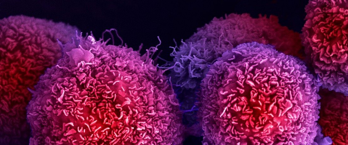 Cancer du pancréas : un diagnostic précoce non invasif grâce au microbiote fécal ?