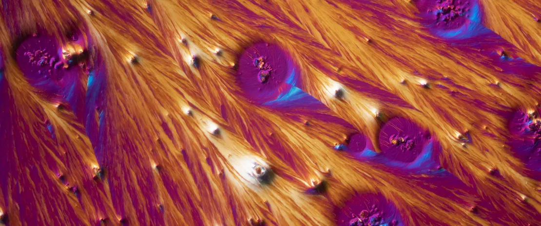 SII, microbiote intestinal et dépression : un triptyque pour mieux comprendre la maladie