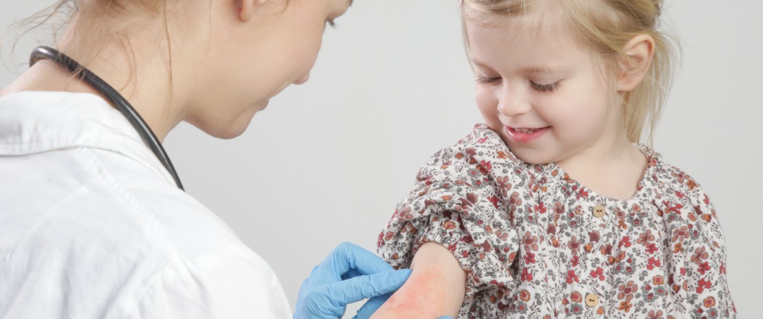 Photo: Dermatite atopique : il faut sauver la peau du champignon Malassezia