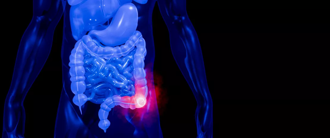 When an oral bacterium turns immune cells into killers