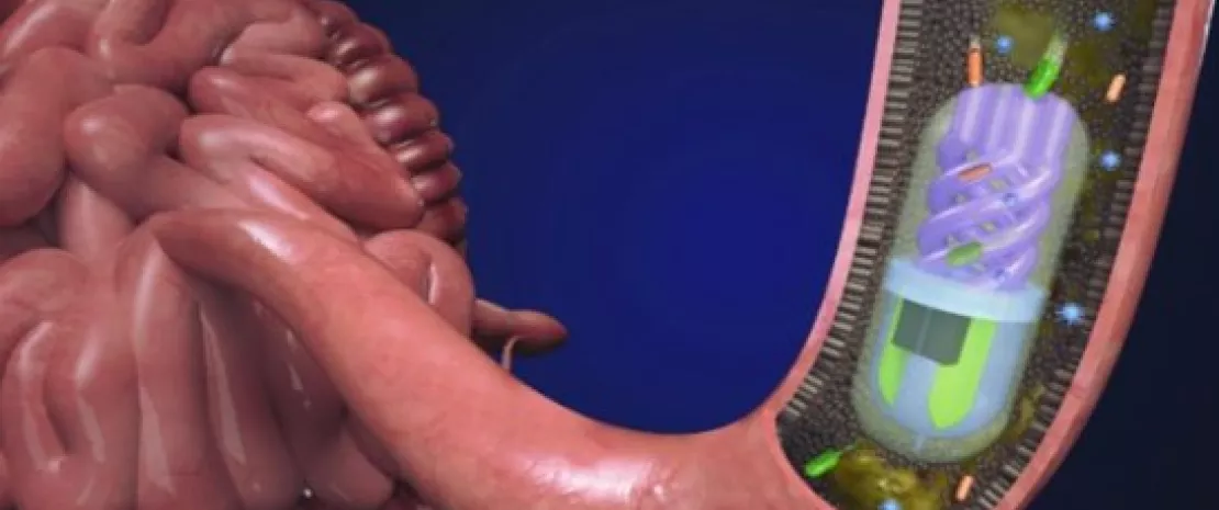 Actu GP : Une gélule high-tech pour prélever le microbiote intestinal