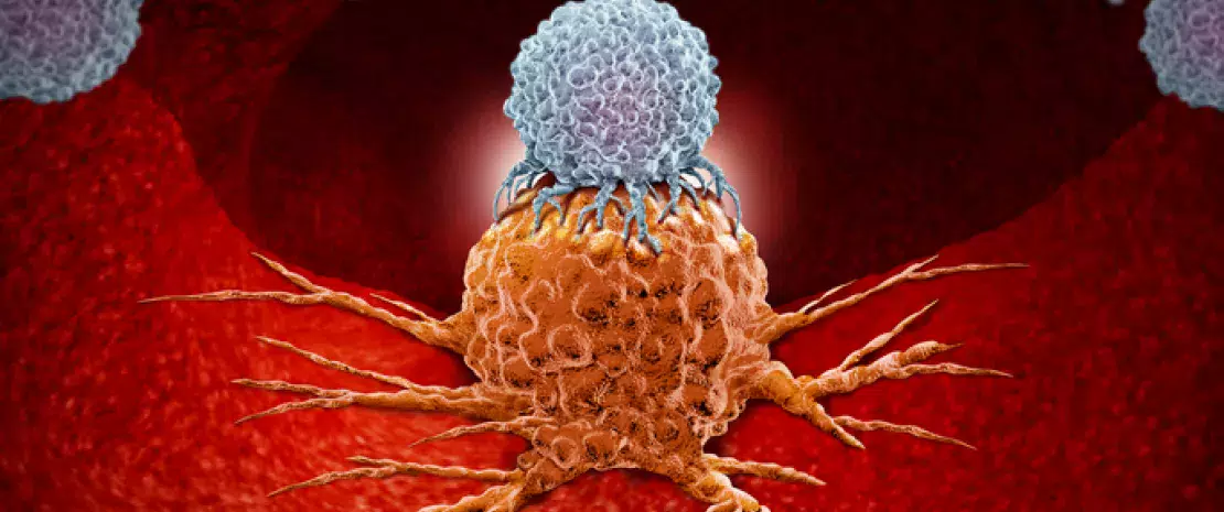 Actu PRO: Immunothérapie et cancer : pas d’antibiothérapie préalable