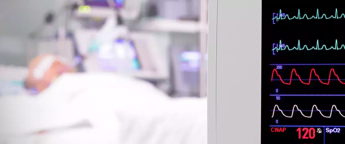 Photo : Gut dysbiosis in ICU patients: a risk factor for antibiotic resistance