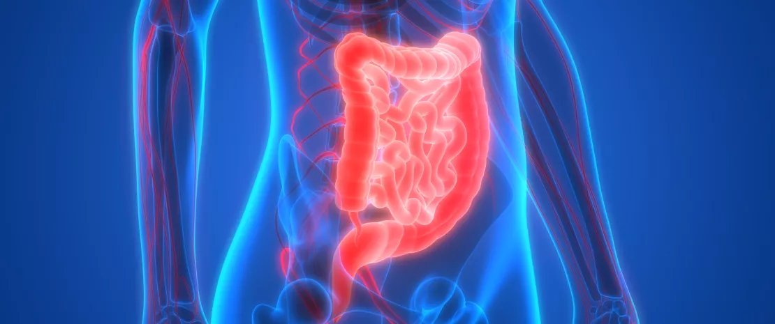 Actu PRO : Crohn : le microbiote iléal, facteur prédictif de récidive ?