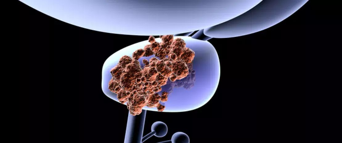 Photo : Gut microbiota: a new player in prostate cancer therapies?