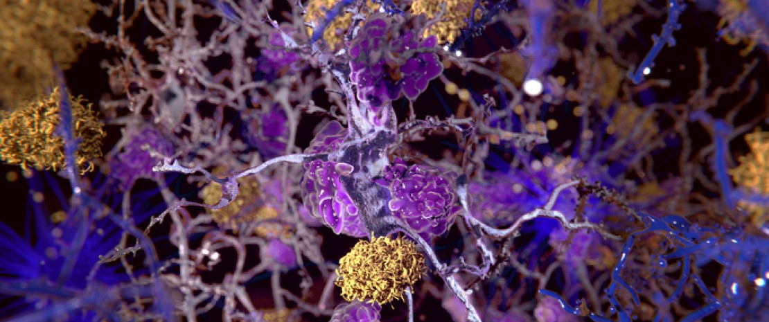Actu PRO : Alzheimer : comment la dysbiose intestinale influencerait la pathologie amyloïde