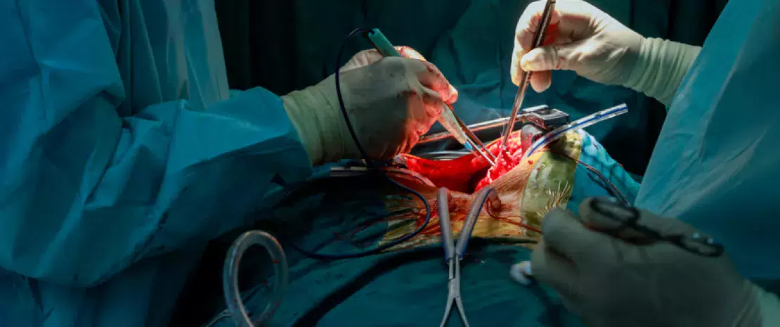 Actu PRO : Greffe de poumon : le microbiote pulmonaire, un indicateur fiable pour prédire le rejet ? 