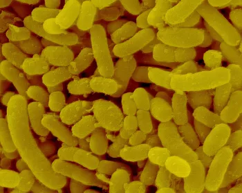 Coloured scanning electron micrograph (SEM) of Prevotella melaninogenica, formerly known as Bacteroides melaninogenicus, is Gram-negative, anaerobic, rod to coccobacillus shaped, prokaryote (bacterium)