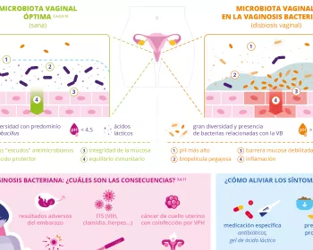 Infografía - Qué es la vaginosis bacteriana - ES