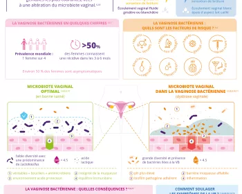 Infographie - Qu'est-ce que la vaginose bactérienne - FR