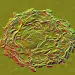 Bacterial vaginosis. Illustration of Gardnerella vaginalis bacteria (rods) attached to epithelial cells, known as clue cells.