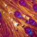 SII, microbiote intestinal et dépression : un triptyque pour mieux comprendre la maladie