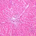 Binge drinking : une dysbiose intestinale liée à l’alcool favoriserait l’addiction