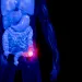 When an oral bacterium turns immune cells into killers