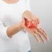 P : Laser et dermatose : Le staphylocoque doré en ligne de mire