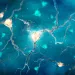Actu PRO : Maladie d’Alzheimer : implication du microbiote buccal confirmée