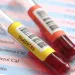 Actu PRO: Microbiote intestinal et métabolites circulants : quelles relations ?