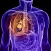 Actu PRO : Cancer du poumon : l'influence majeure du microbiote pulmonaire