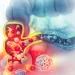 Actu PRO : Cancer colorectal : de la dysbiose à l’altération ADN