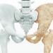 Actu GP : Analyser le microbiote intestinal pour déterminer le risque d’ostéoporose ?