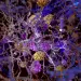 Actu PRO : Alzheimer : comment la dysbiose intestinale influencerait la pathologie amyloïde