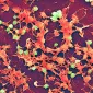 Scanning Electron Micrograph (SEM) depicting large numbers of Staphylococcus aureus bacteria, which were found on the luminal surface of an indwelling catheter.