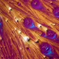 SII, microbiote intestinal et dépression : un triptyque pour mieux comprendre la maladie