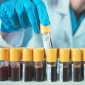 Actu PRO : Le sang, indicateur de la diversité du microbiote intestinal ?