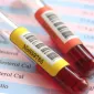 Actu PRO: Microbiote intestinal et métabolites circulants : quelles relations ?
