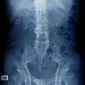 Actu PRO : Spondylarthrite ankylosante : le microbiote fongique également en cause