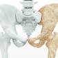 Actu GP : Analyser le microbiote intestinal pour déterminer le risque d’ostéoporose ?