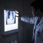 Actu PRO : Le microbiote buccal, facteur de risque de cancer pulmonaire ?