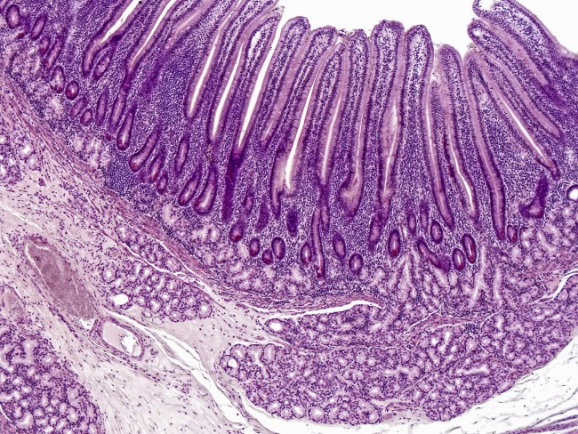 Light micrograph of a human duodenum. HE stain, Magnification: 40X