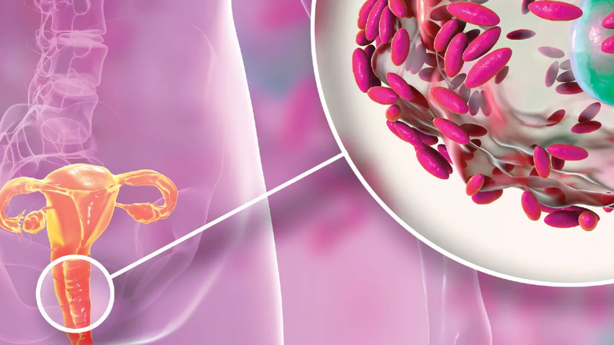 DIY сексуалдық киімдері