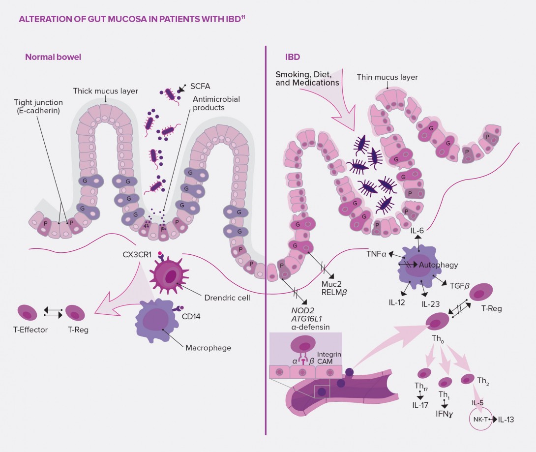 Role of the intestinal epithelium infography