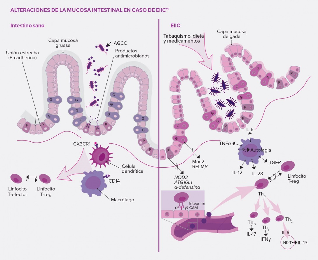 Papel-del-epitelio-intestinal-y-de-la-respuesta-inmunitaria-innata